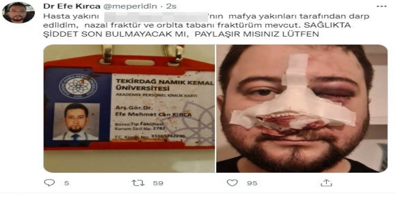 ACİL DOKTORUNUN HASTA YAKINI TARAFINDAN BURNU KIRILDI