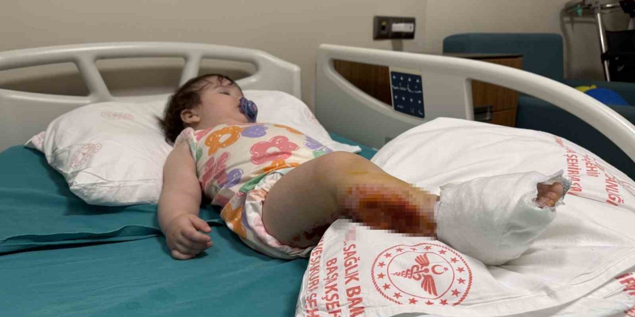 ÜZERİNE ÇAYDANLIK DEVRİLEN 1 YAŞINDAKİ BEBEK DEHŞETİ YAŞADI, VÜCUDUNUN YÜZDE 15’İ YANDI