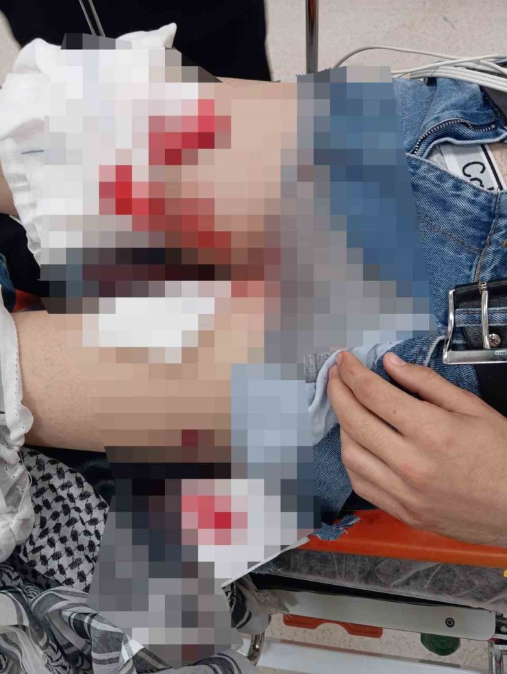 SULTANGAZİ’DE DÜĞÜN ÇIKIŞI KANLI SALDIRI: 19 YAŞINDAKİ GENÇ KURŞUNLARIN HEDEFİ OLDU