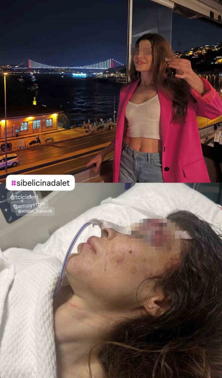 BEŞİKTAŞ’TA İŞ GÖRÜŞMESİNE GİDEN KADINA BOKS HOCASINDAN BIÇAKLI VE YUMRUKLU SALDIRI